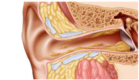 助听器的保养频率：需定期到颜培中心更换