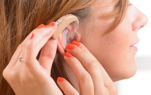 耳蜗助听器
