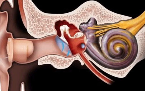 骨导助听器和传统气导助听器有何区别？