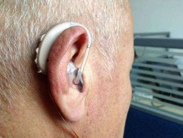 奥迪康助听器是否值得入手呢？